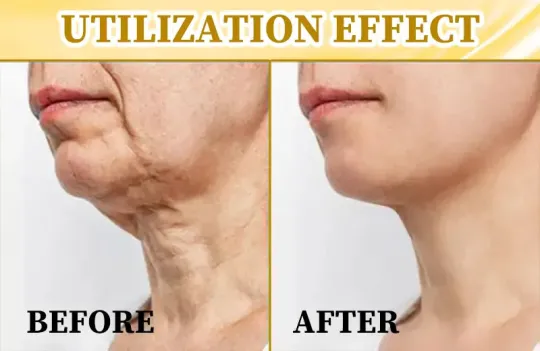 Fivfivgo™ Ultra-Firming & Repairing Multi-Purpose Cream: Reshape skin, activate cells