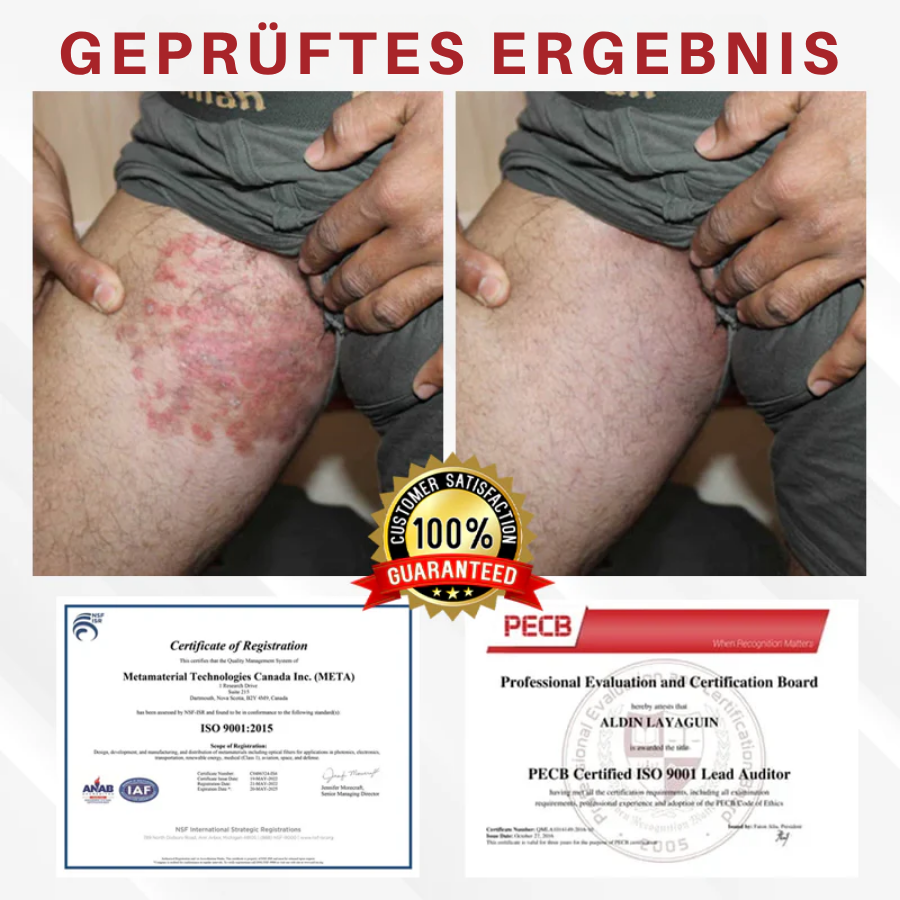 Fivfivgo® Männer HPV Warzen Pflege Spray