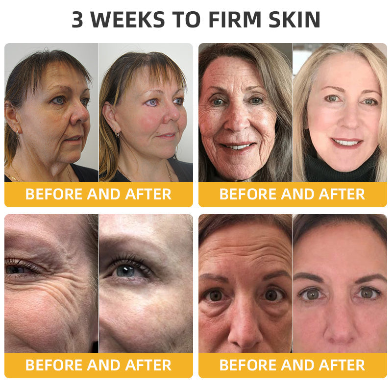 Fivfivgo™ BeeLift Anti-Aging Firming Cream (Address Crepe & Sagging) 🔥 LAST DAY SALE 70% OFF