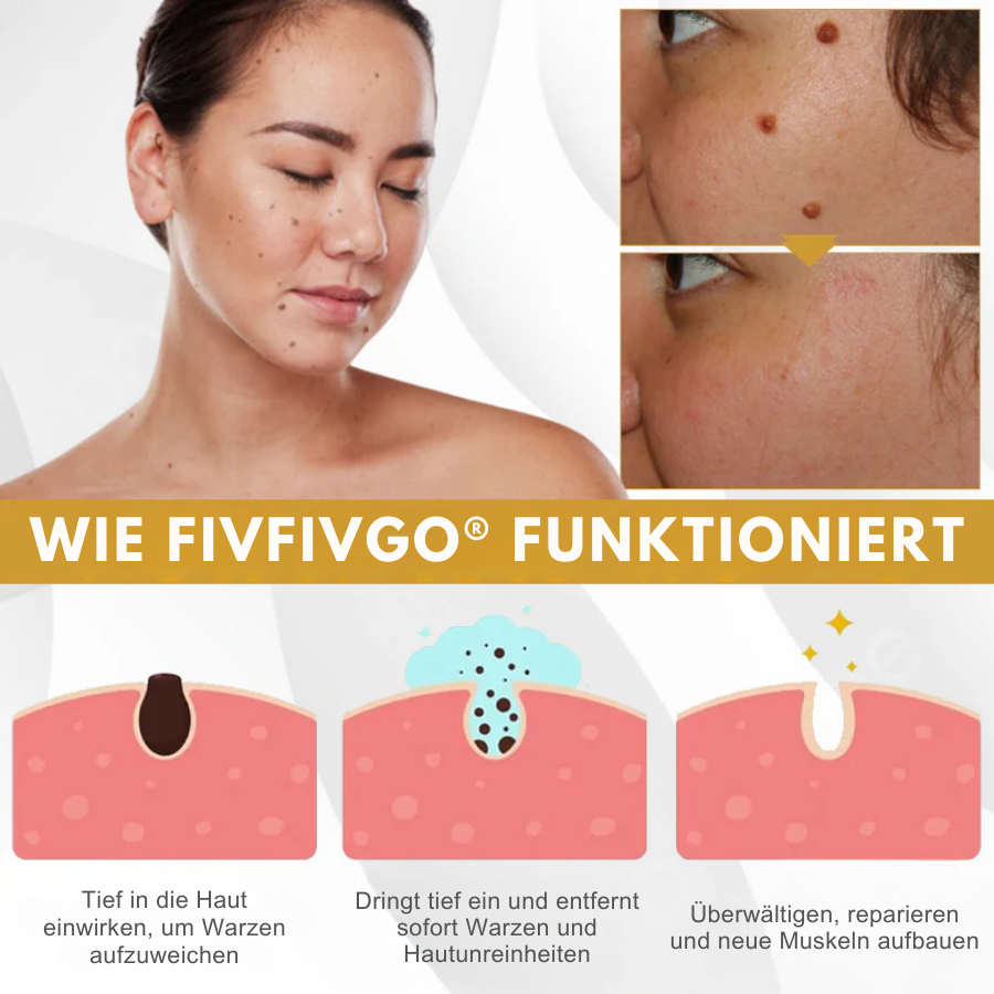 Fivfivgo® Fortschrittliches Maulwurf & Fleck Korrigierendes Bienengel