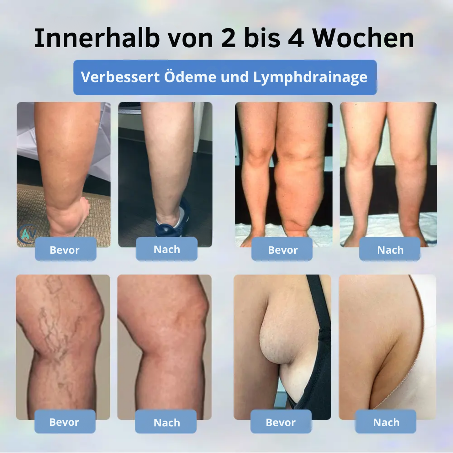Fivfivgo® Schwarzkümmel Entgiftend Kräutercreme