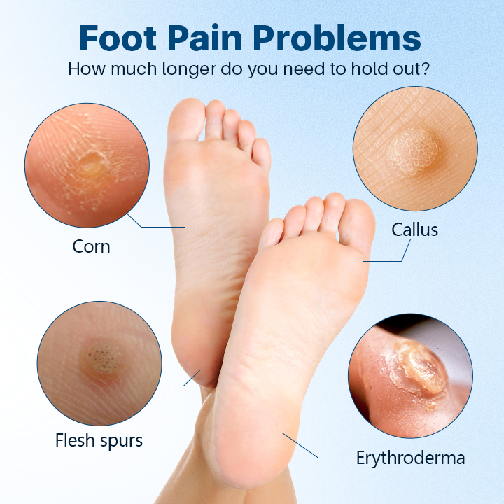 Fivfivgo™ FootGlow Pro-Strength Corn & Callus Remover Gel