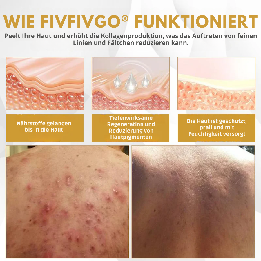 Fivfivgo® Fortschrittliches Maulwurf & Fleck Korrigierendes Bienengel