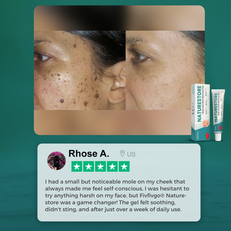 Fivfivgo® NatureStore Mole and Wart Removal Gel