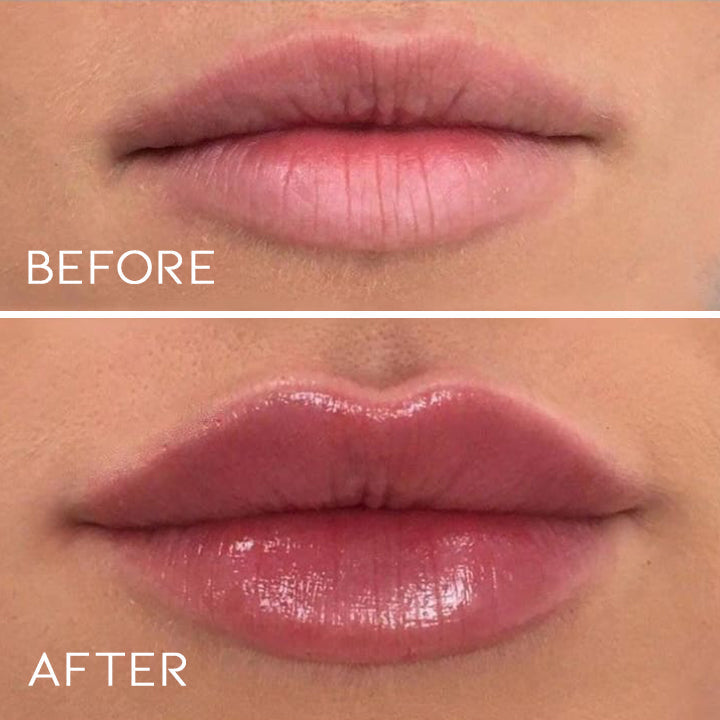 Day&Night Lip Plumper Set Personal Care Every Day And Night 