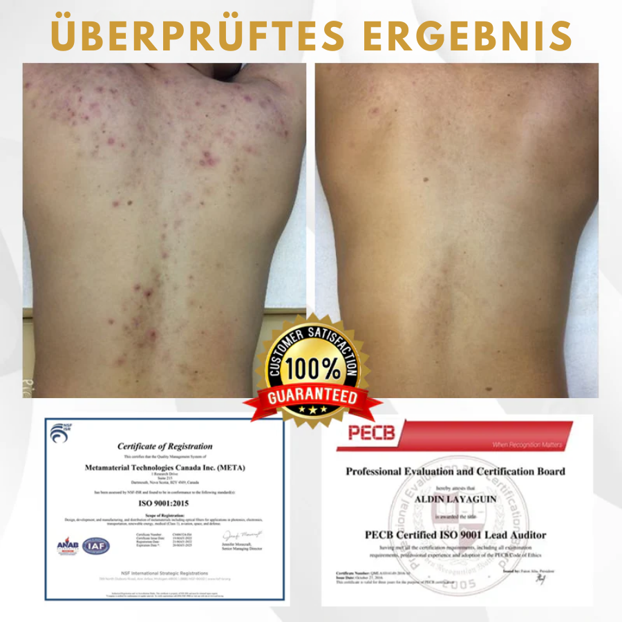 Fivfivgo® Fortschrittliches Maulwurf & Fleck Korrigierendes Bienengel