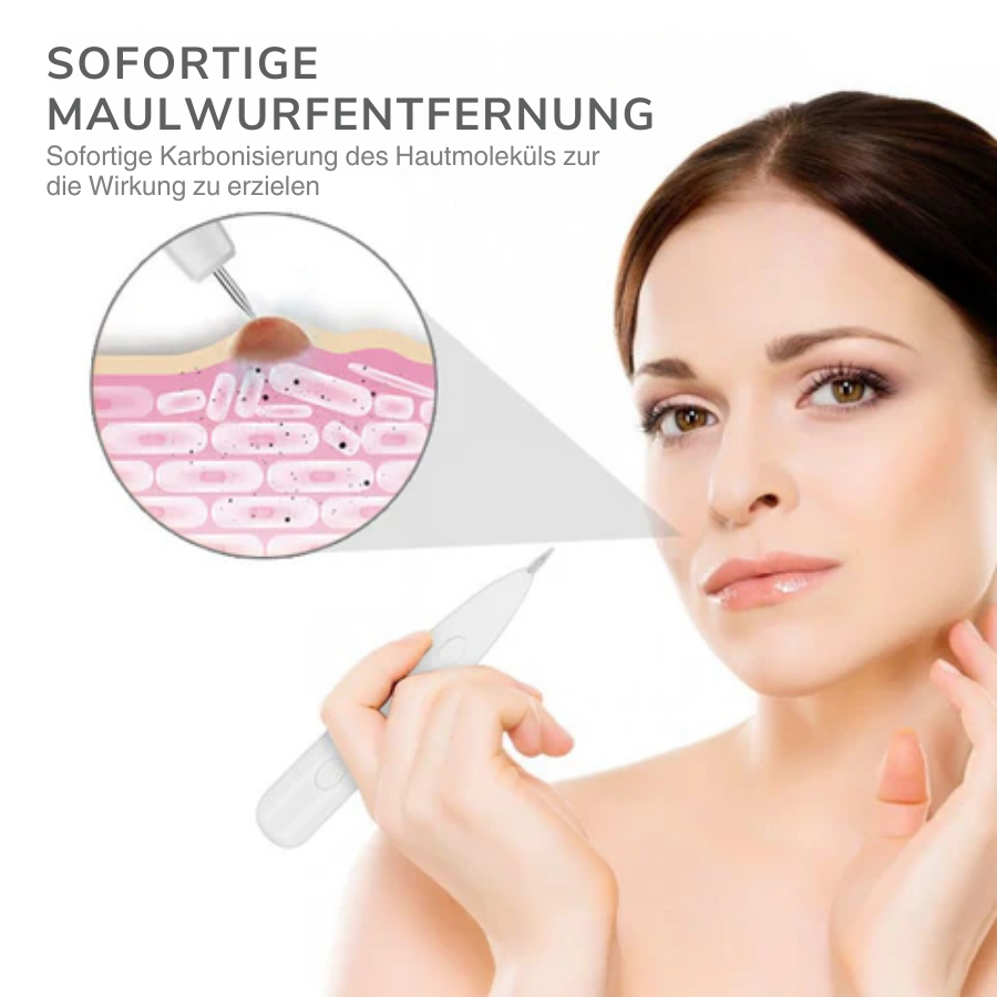 Fivfivgo™ Tragbarer Laser-Spot-Reinigungsstift