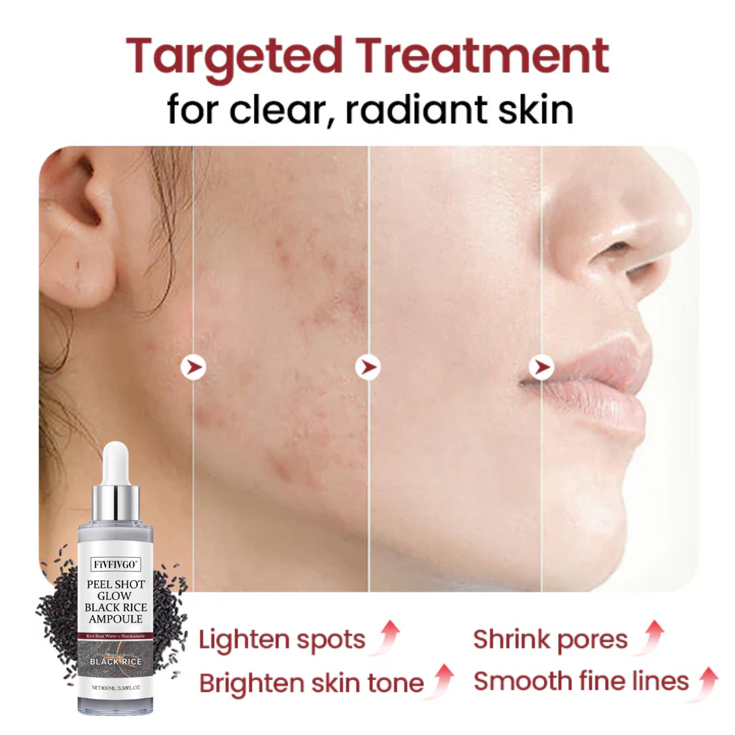 Fivfivgo® Peel Shot Glow Black Rice Ampoule