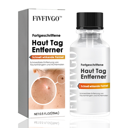 Fivfivgo™ Fortgeschrittene Haut Tag Entferner - Schnell wirkende Formel