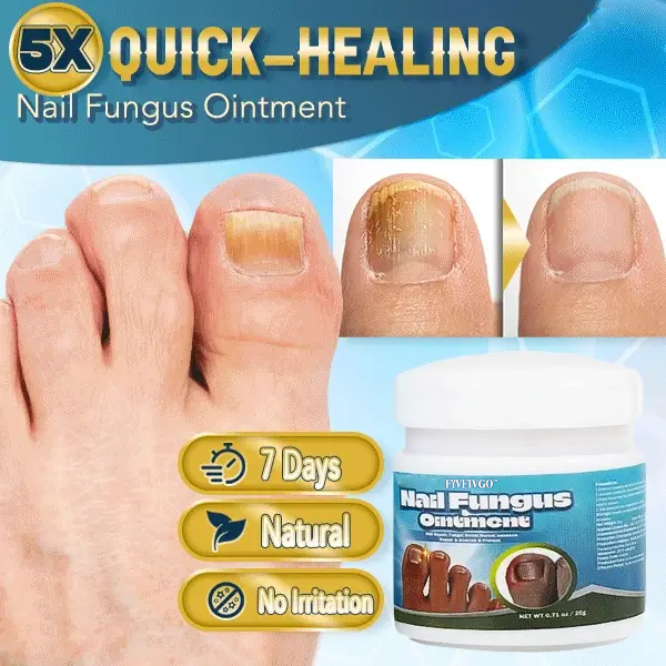 Fivfivgo™ 5X Schnellheilende Nagelpilzsalbe