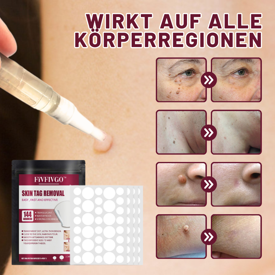 Fivfivgo™ Haut Tag Entfernungsaufkleber