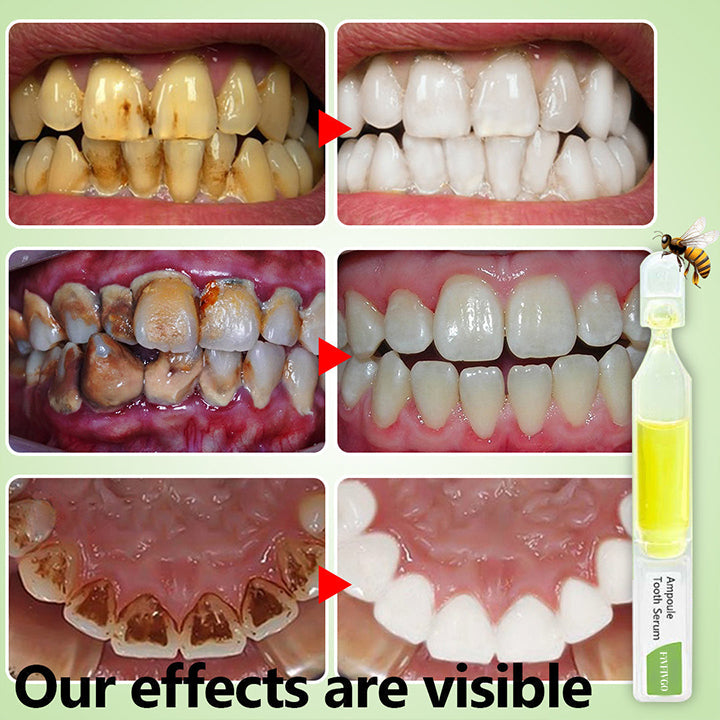 Fivfivgo™ Nuova Zelanda Veleno d'api fiala dentifricio
