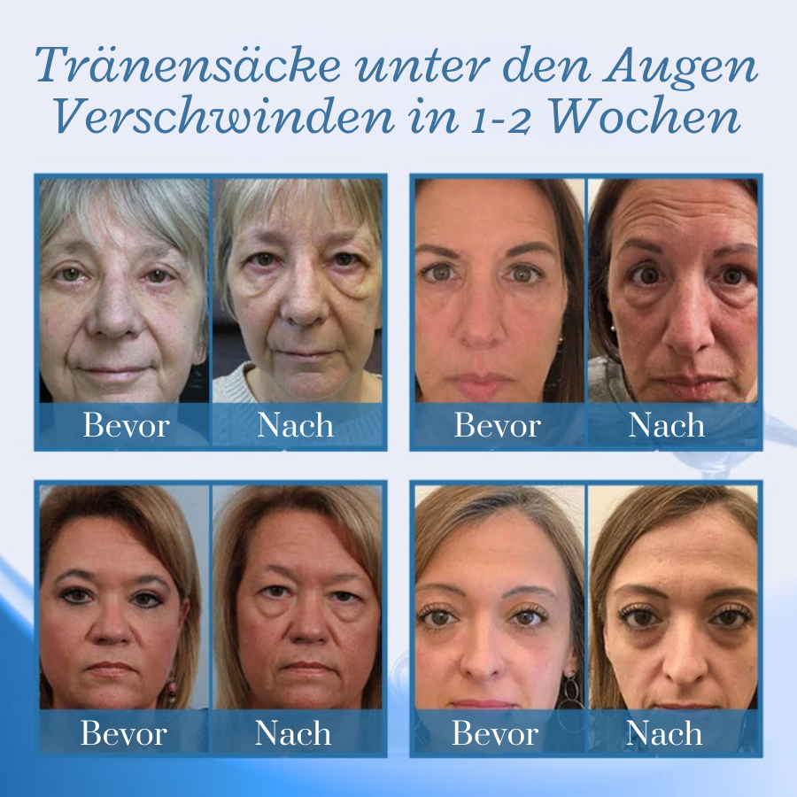 Fivfivgo® BotoxPLUS Retinol Augencreme - Dermatologe empfohlen (Augencreme gegen feine Linien, Falten, dunkle Augenringe, dunkle Flecken und tägliches Anti-Aging)