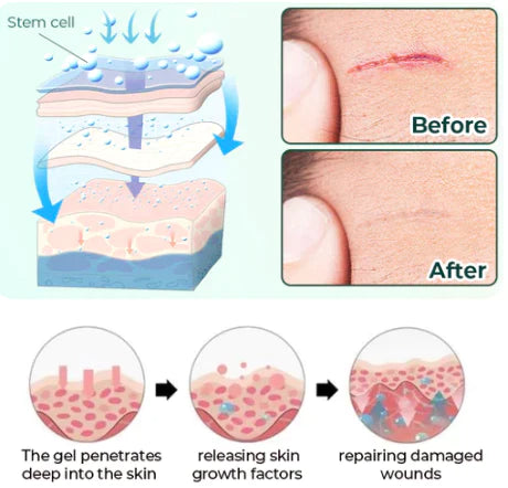 Fivfivgo™ Advanced Medical Stem Cell Scar Gel