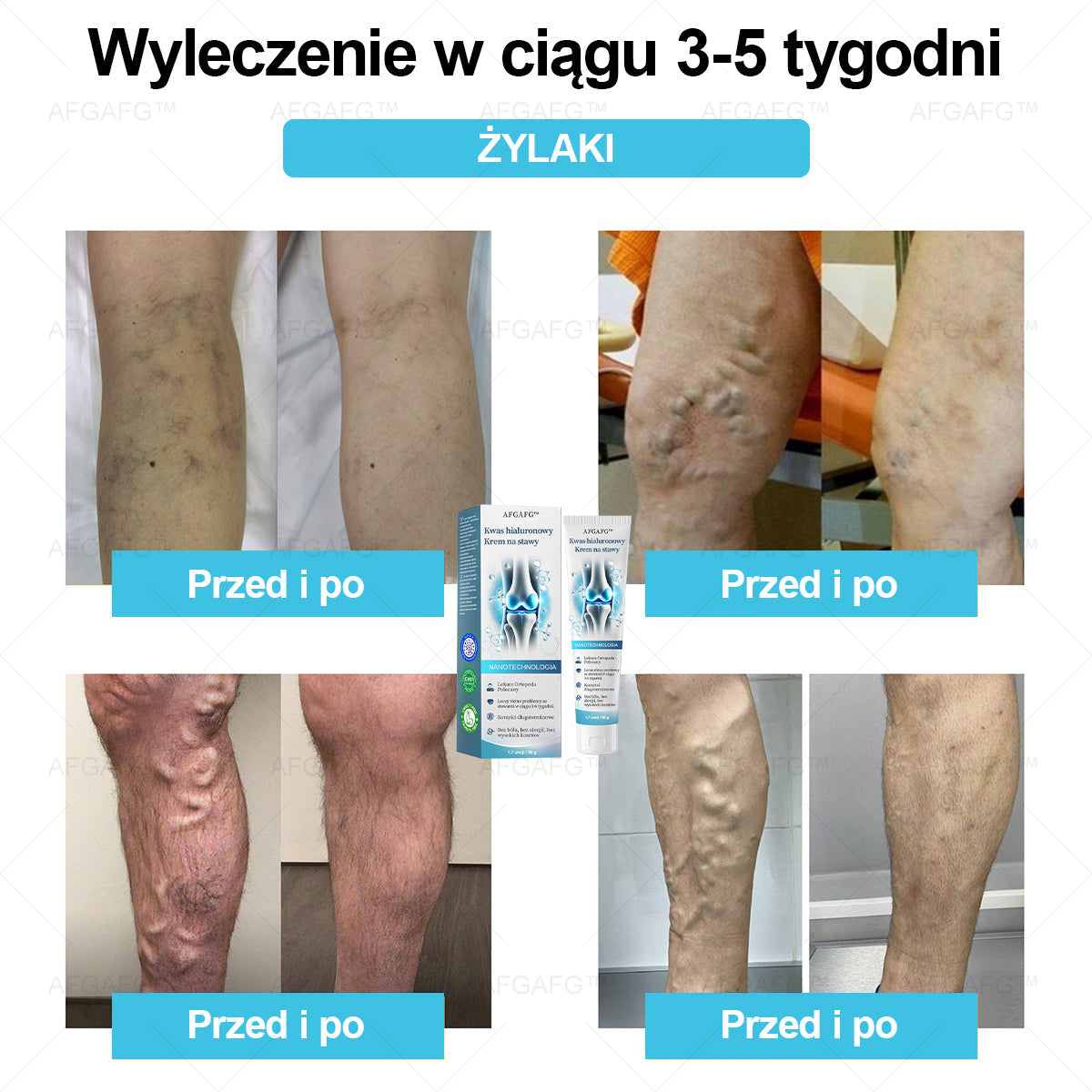 AFGAFG™ 𝐇𝐲𝐚𝐥𝐮𝐫𝐨𝐧𝐢𝐜 𝐀𝐜𝐢𝐝 𝐉𝐨𝐢𝐧𝐭 𝐑𝐞𝐩𝐚𝐢𝐫 𝐂𝐫𝐞𝐚𝐦👩‍⚕️（𝐓𝐡𝐨𝐫𝐨𝐮𝐠𝐡 𝐭𝐫𝐞𝐚𝐭𝐦𝐞𝐧𝐭  𝐨𝐟 AFGAFG™, 𝐧𝐞𝐮𝐫𝐚𝐥𝐠𝐢𝐚, 𝐦𝐮𝐬𝐜𝐥𝐞 𝐩𝐚𝐢𝐧𝐬）