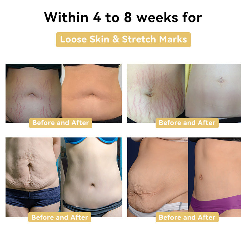 Fivfivgo™ Bee Venom Slimming Cream