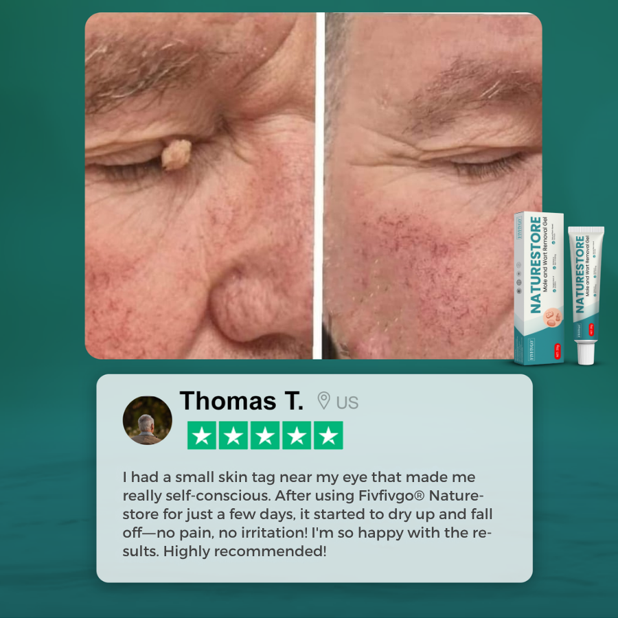 Fivfivgo® NatureStore Mole and Wart Removal Gel