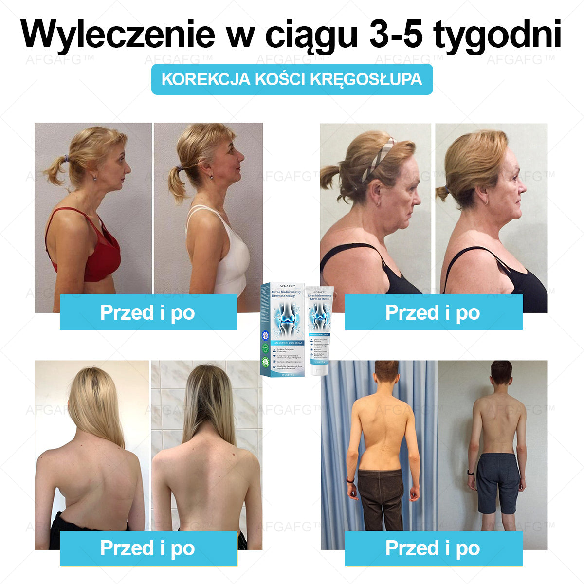 AFGAFG™ 𝐇𝐲𝐚𝐥𝐮𝐫𝐨𝐧𝐢𝐜 𝐀𝐜𝐢𝐝 𝐉𝐨𝐢𝐧𝐭 𝐑𝐞𝐩𝐚𝐢𝐫 𝐂𝐫𝐞𝐚𝐦👩‍⚕️（𝐓𝐡𝐨𝐫𝐨𝐮𝐠𝐡 𝐭𝐫𝐞𝐚𝐭𝐦𝐞𝐧𝐭  𝐨𝐟 AFGAFG™, 𝐧𝐞𝐮𝐫𝐚𝐥𝐠𝐢𝐚, 𝐦𝐮𝐬𝐜𝐥𝐞 𝐩𝐚𝐢𝐧𝐬）