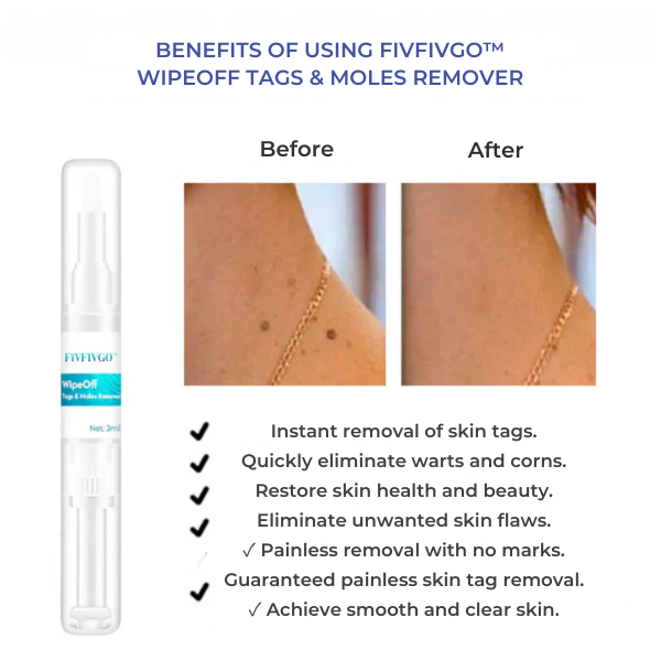 Fivfivgo™ WipeOff Tags & Maulwurfsentferner