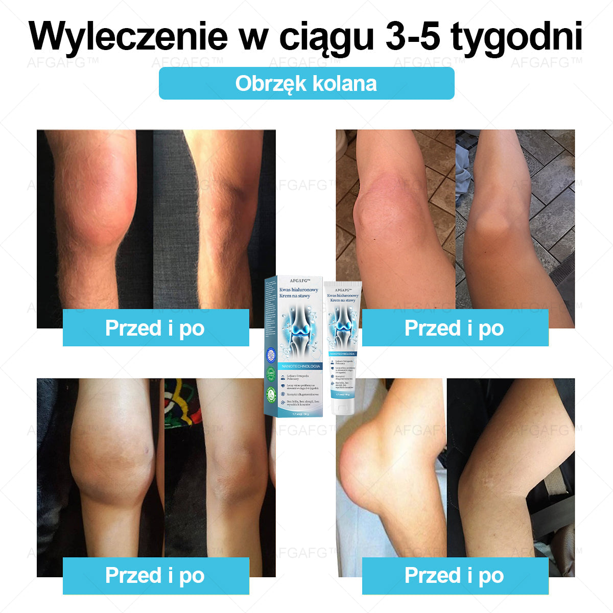 AFGAFG™ 𝐇𝐲𝐚𝐥𝐮𝐫𝐨𝐧𝐢𝐜 𝐀𝐜𝐢𝐝 𝐉𝐨𝐢𝐧𝐭 𝐑𝐞𝐩𝐚𝐢𝐫 𝐂𝐫𝐞𝐚𝐦👩‍⚕️（𝐓𝐡𝐨𝐫𝐨𝐮𝐠𝐡 𝐭𝐫𝐞𝐚𝐭𝐦𝐞𝐧𝐭  𝐨𝐟 AFGAFG™, 𝐧𝐞𝐮𝐫𝐚𝐥𝐠𝐢𝐚, 𝐦𝐮𝐬𝐜𝐥𝐞 𝐩𝐚𝐢𝐧𝐬）