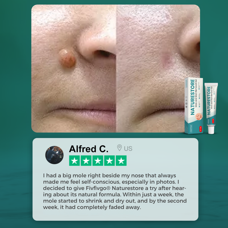 Fivfivgo® NatureStore Mole and Wart Removal Gel