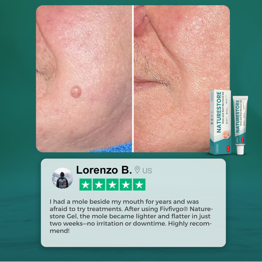 Fivfivgo® NatureStore Mole and Wart Removal Gel