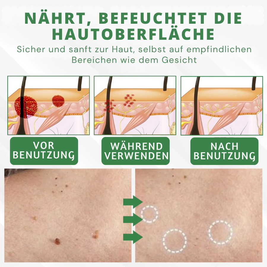 Fivfivgo® Herdle Shot Flecken- & Maulwurfskorrektur-Serum