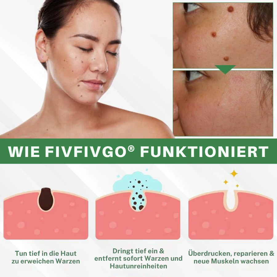 Fivfivgo® Herdle Shot Flecken- & Maulwurfskorrektur-Serum