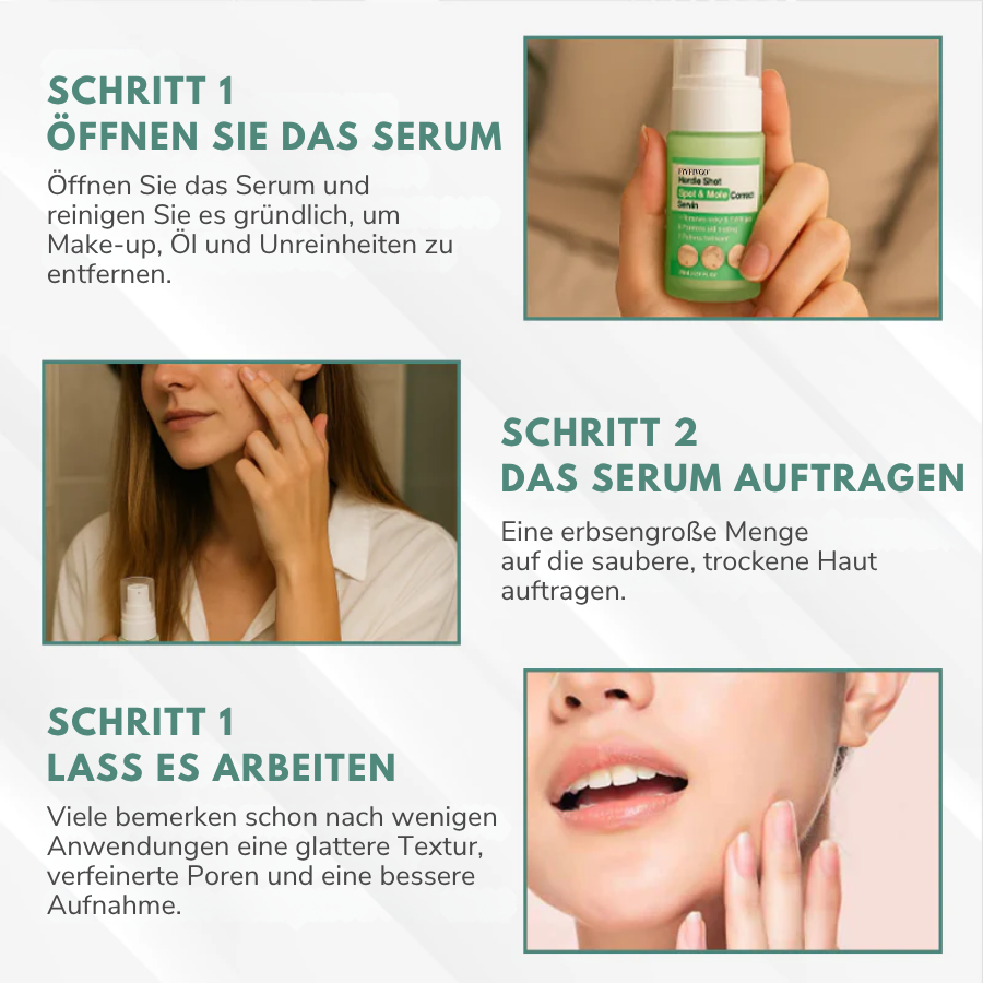 Fivfivgo® Herdle Shot Flecken- & Maulwurfskorrektur-Serum