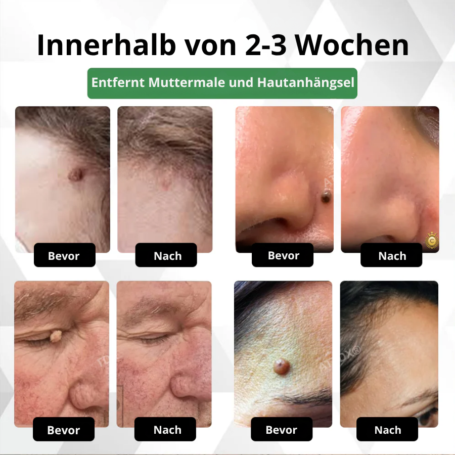 Fivfivgo® Herdle Shot Flecken- & Maulwurfskorrektur-Serum