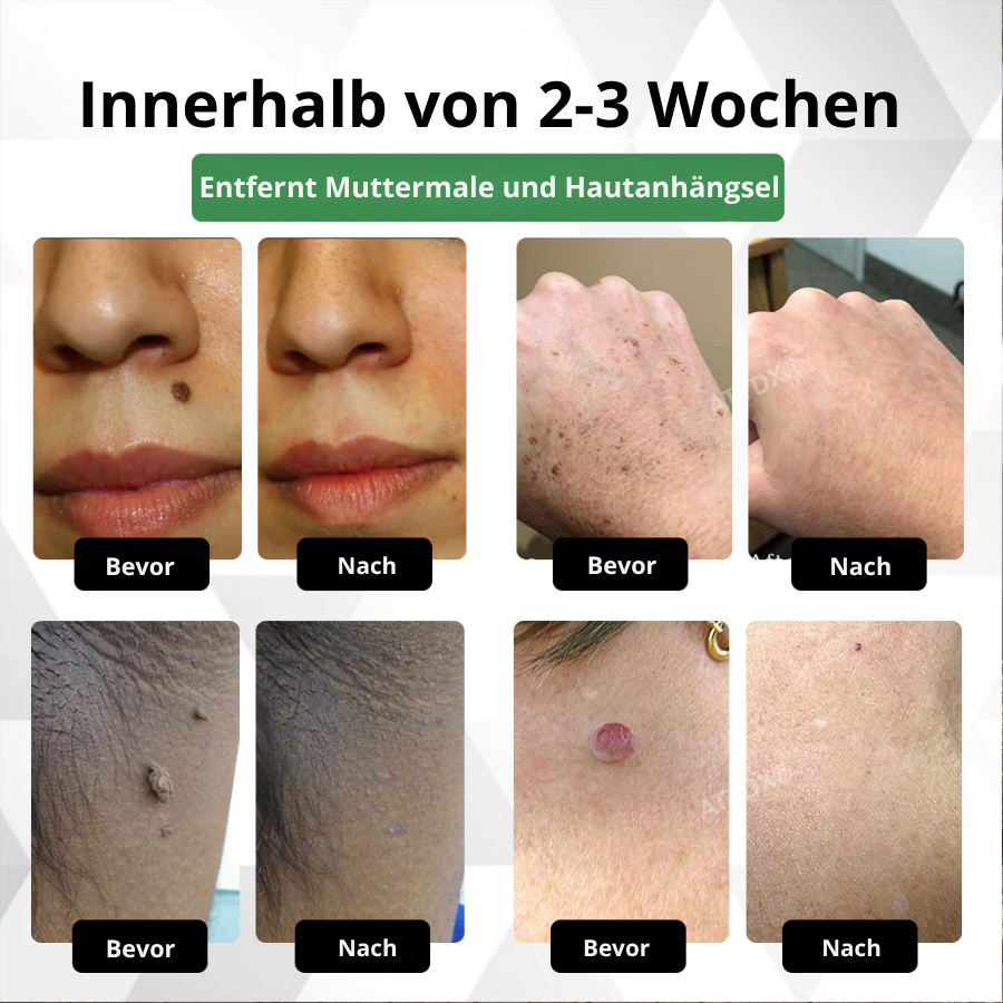 Fivfivgo® Herdle Shot Flecken- & Maulwurfskorrektur-Serum