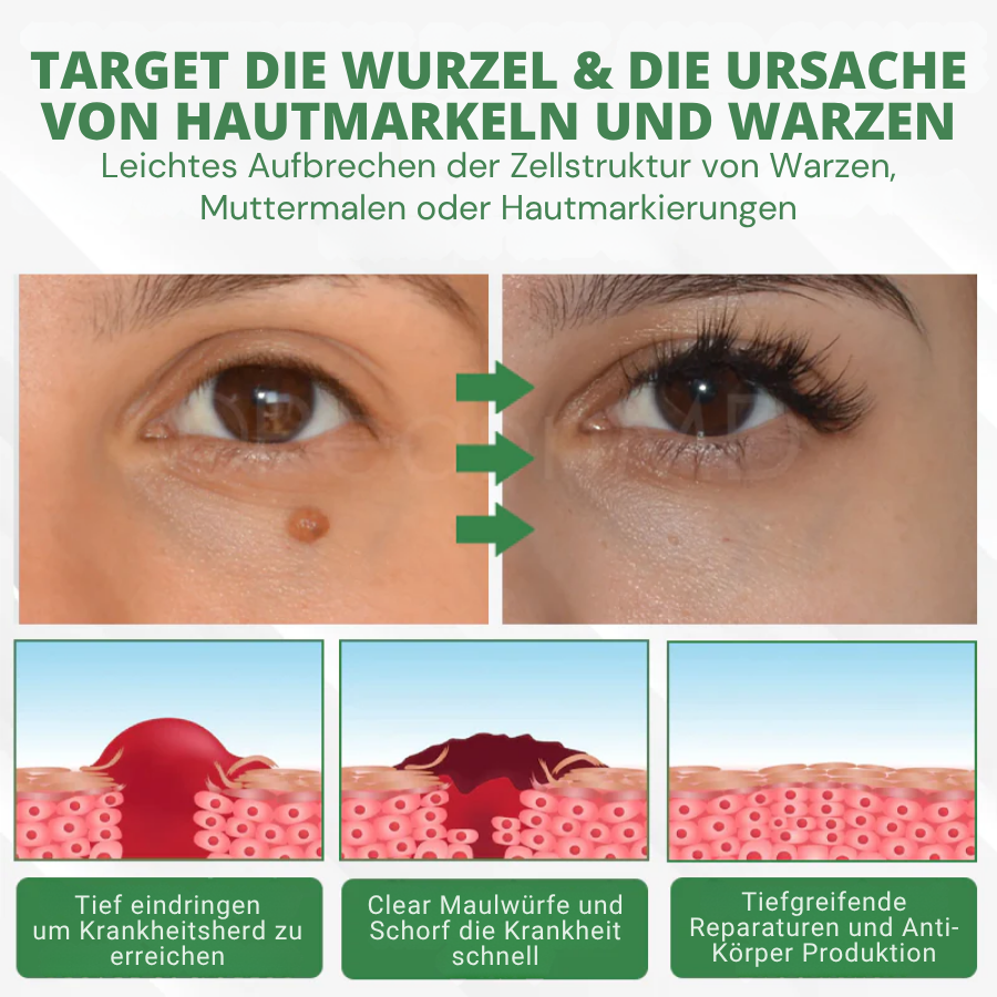 Fivfivgo® Herdle Shot Flecken- & Maulwurfskorrektur-Serum