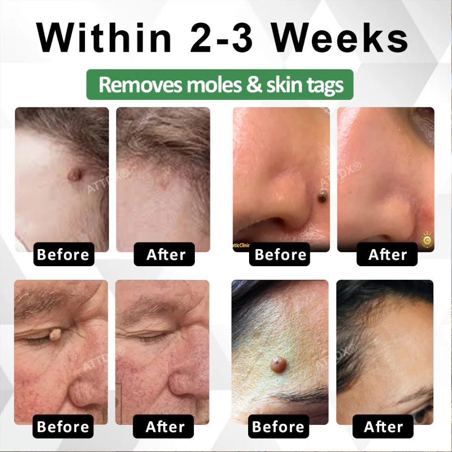 Fivfivgo® Herdle Shot Spot & Mole Correct Serum