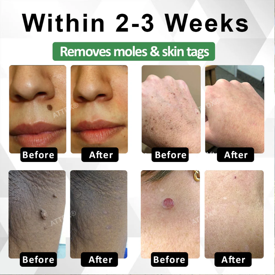 Fivfivgo® Herdle Shot Spot & Mole Correct Serum