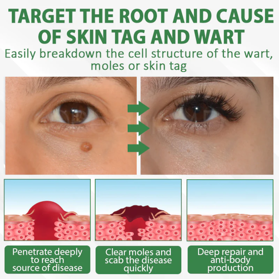 Fivfivgo® Herdle Shot Spot & Mole Correct Serum