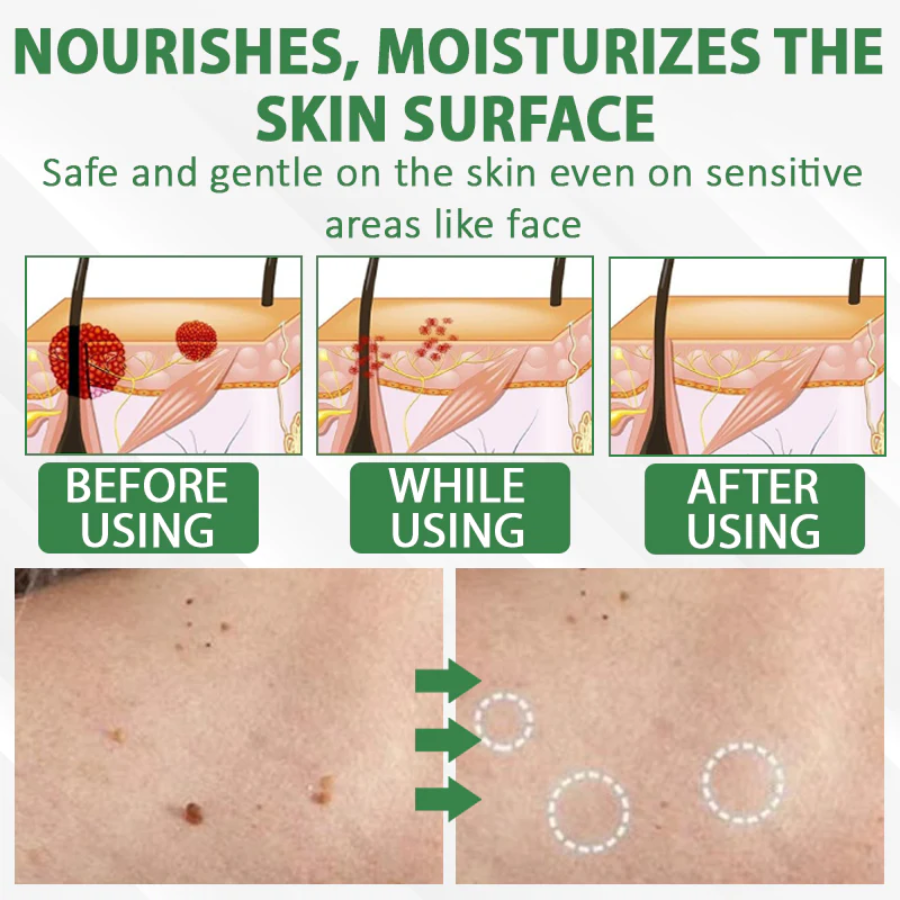 Fivfivgo® Herdle Shot Spot & Mole Correct Serum