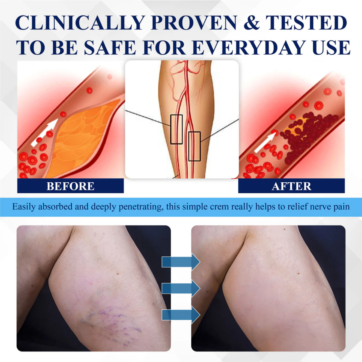 NovaRX® NerveRelief LC Medical Treatment Cream