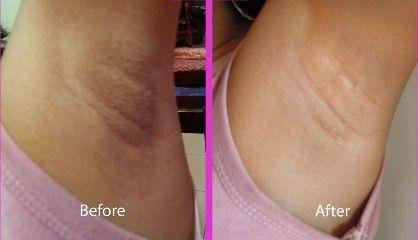 Multi-purpose Pinkish Cream