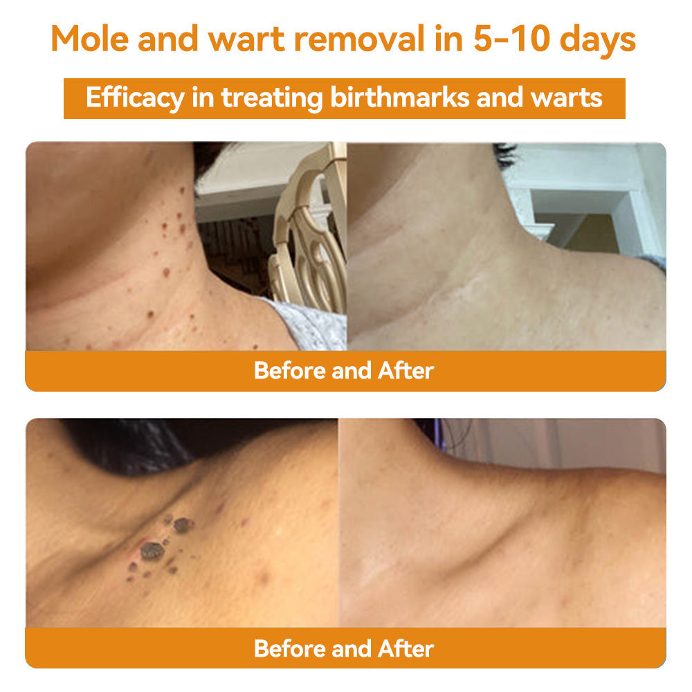 Fivfivgo™ Bee Poison Skin Treatment Cream