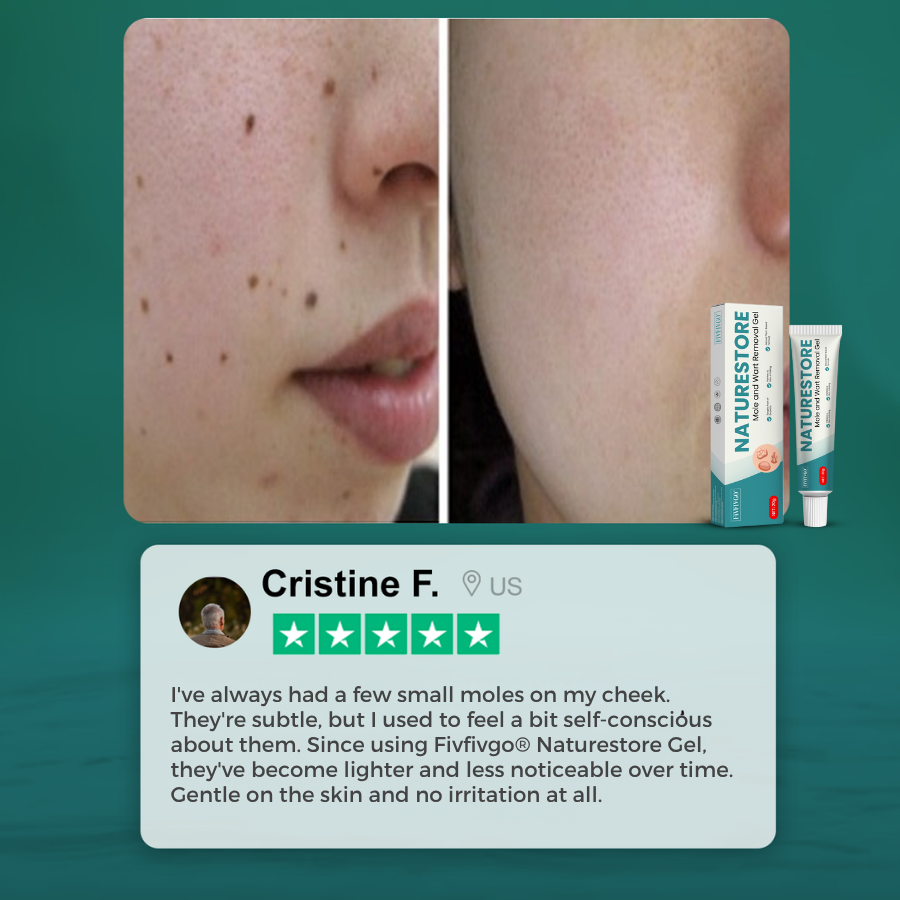 Fivfivgo® NatureStore Mole and Wart Removal Gel