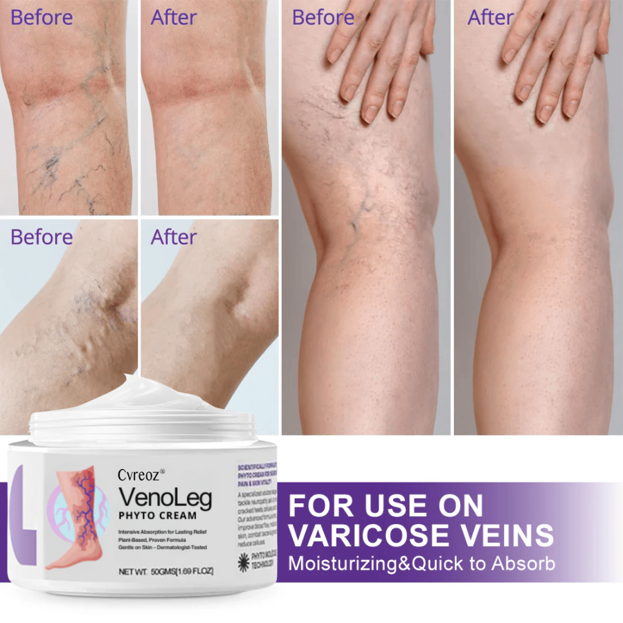 Cvreoz® VenoLeg Phyto Cream - Visible Results in Just 4 Days🔥