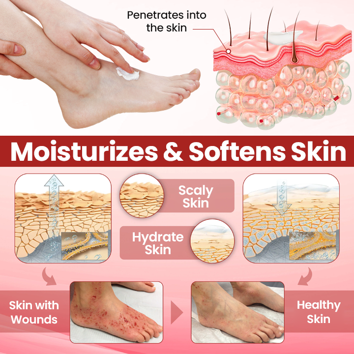 Cvreoz® DiaCare Diabetic Treatment Cream