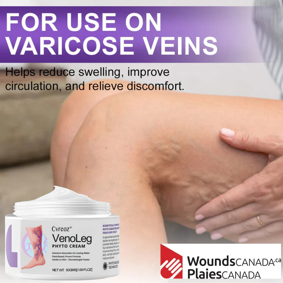 Cvreoz® VenoLeg Phyto Cream - Visible Results in Just 4 Days🔥