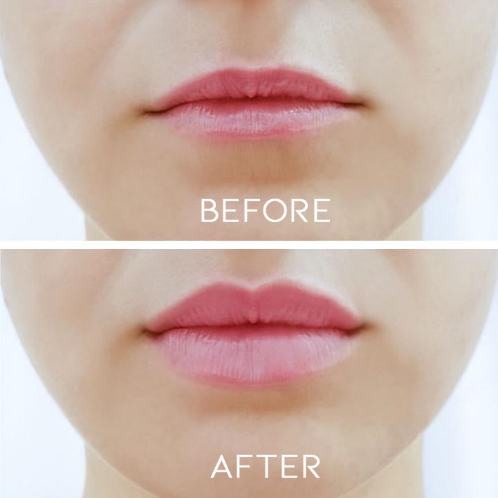 Day&Night Lip Plumper Set Personal Care Every Day And Night 
