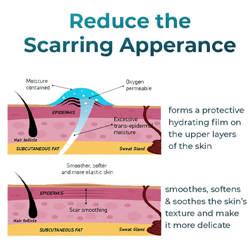 Fivfivgo™ Advanced Scar Removal Gel
