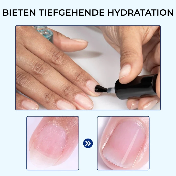 Bikenda® OnyxoGuard Wachstum der Nägel und Reparaturserum