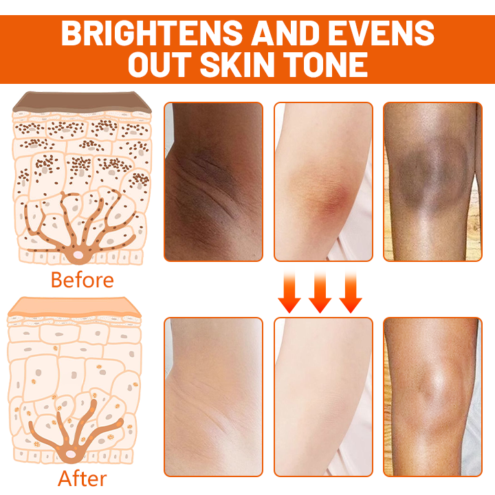 Fivfivgo™ Vitamin C Brightening Repair Cream