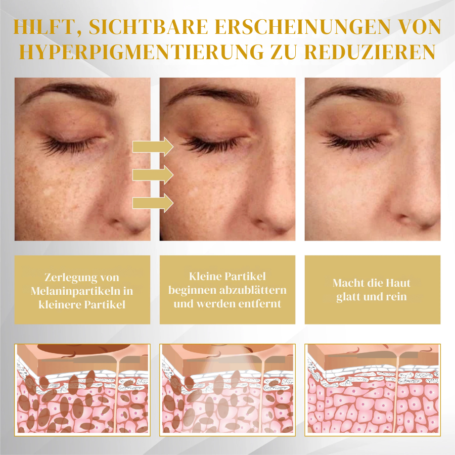 Fivfivgo® Fortschrittliches Maulwurf & Fleck Korrigierendes Bienengel