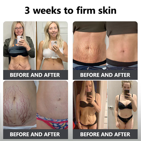 Fivfivgo™ Flüssiges Peptid-Peeling-Essenz