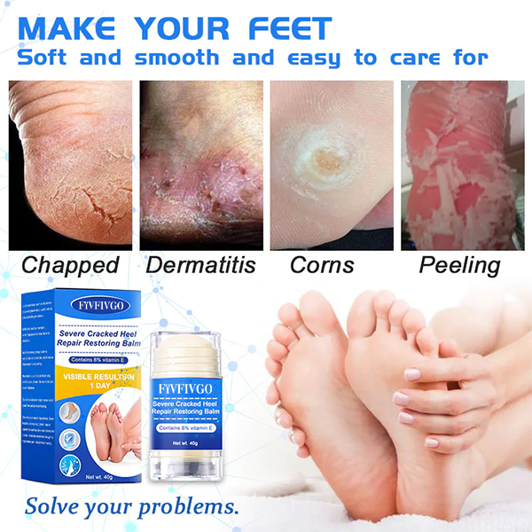 Fivfivgo™ Intense Cracked Heel Repair Cream